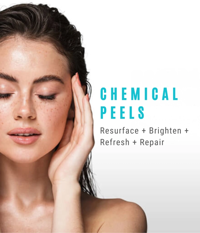 chemical-peels-mobile